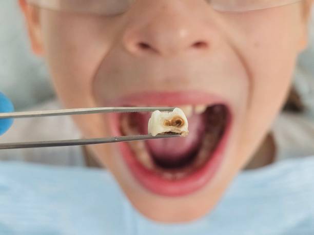 Best Same-Day Emergency Dentist in Middlebranch, OH